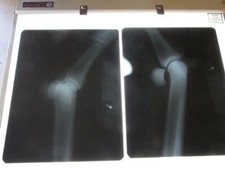 Vintage 1960s Portable X-Ray