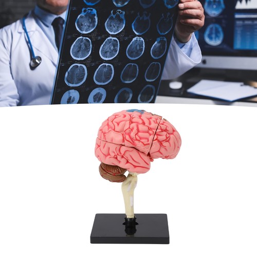 Brain model neuroanatomy - —brain,