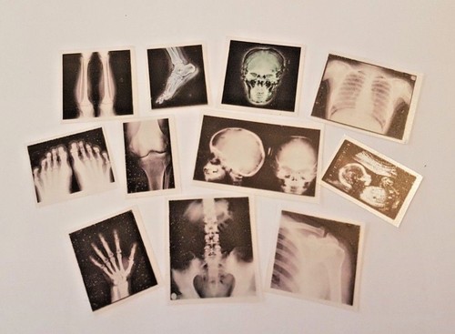 Xray x10 miniature - xray, or