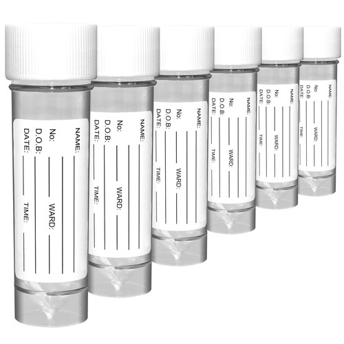 Gen plastic screw - screw, top