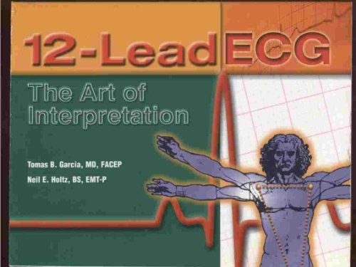 Lead ecg the art - ecg:, of