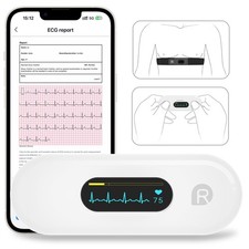 2025 New ER2-S Mobile ECG EKG