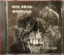 Sick Sinus Syndrome - Rotten