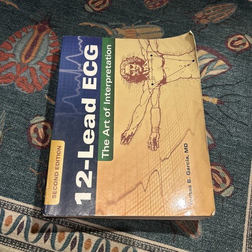 Lead ecg the - 12-lead, of