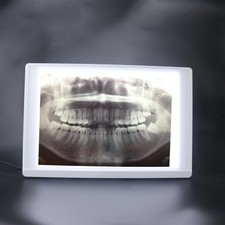 Dental X-Ray Film Illuminator