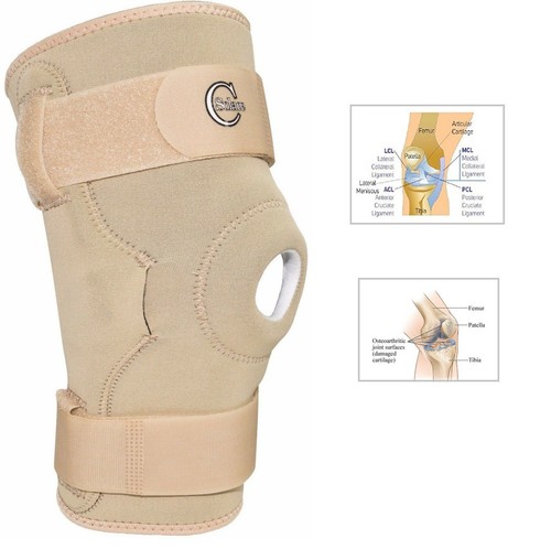 Knee hinged arthritis - knee,