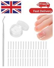 (50+1) Pcs Ingrown Toenail Treatment Corrector Set, Professional Pain-Free
