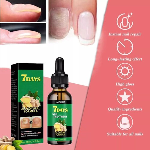 Newginger nail treatment - newginger,