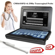 CMS600P2 Portable Ultrasound Scanner Laptop Ultrasound Machine 6.5M Transvaginal