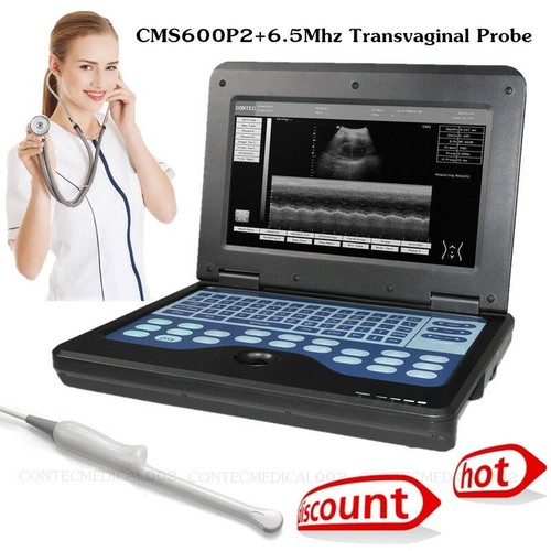 Cms600p2 portable ultrasound - cms600p2,