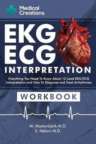 Ekg ecg interpretation - ekg/ecg,