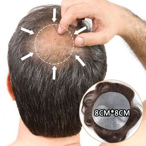 Bald spot hair patch remy - bald,