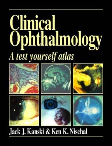 Clinical ophthalmology test - ophthalmology:,