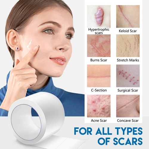 Medical silicone scar tape - scar,
