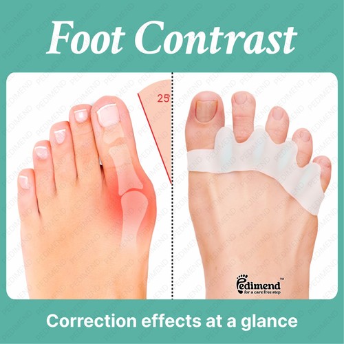 Pedimend gel toe - toe, separator