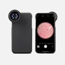 XMSJ Electronic Dermatoscope