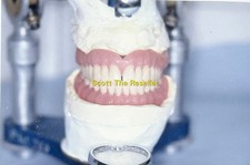 DENTURE SET UPPER LOWER FULL TEETH MOLDS LAB MODEL 35MM SLIDE