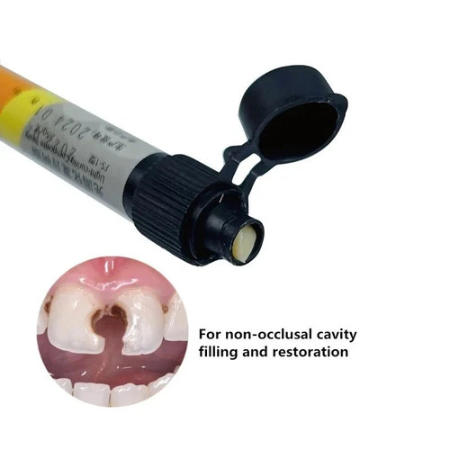 New dental cement cavity - dental,
