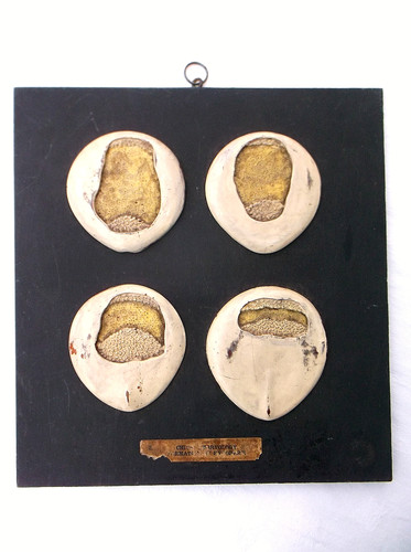 Rare antique anatomical - a,