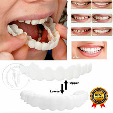 Smile Snap On False Teeth