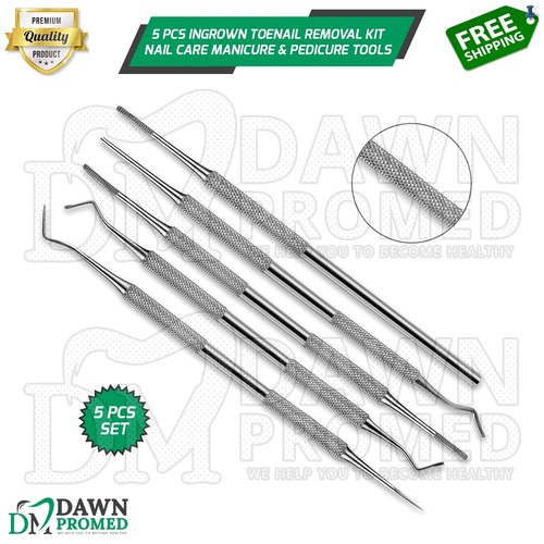 Pcs ingrown toenail - ingrown, removal
