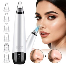 Electric Blackhead Remover