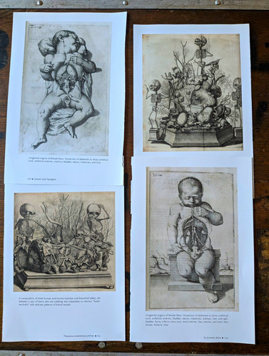 Antique anatomical print - anatomical,