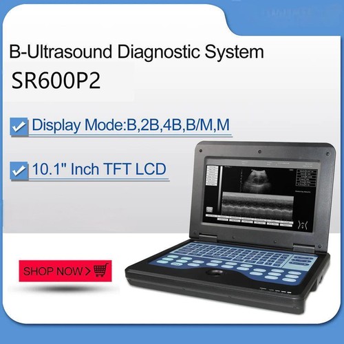 Portable ultrasound scanner - portable,