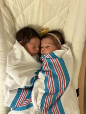 Twins Mick Awake & Mick Asleep