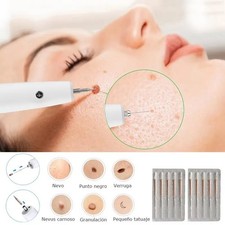 Laser Plasma Pen Mole Removal