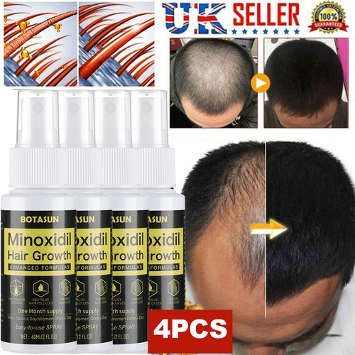 4pc minoxidil hair - 4pc,