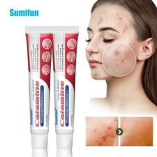 New 20g rosacea ointment treat - 20g,