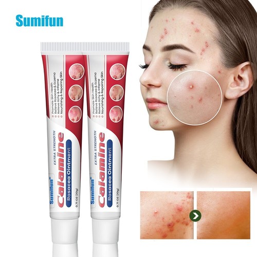 New 20g rosacea ointment treat - new,