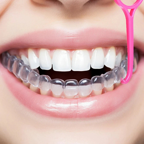 Invisalign aligner removal - invisalign,