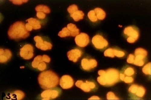 Microscope slide stain - microscope,