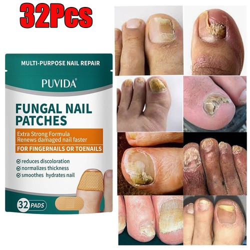 32pcs anti fungal nail - anti,