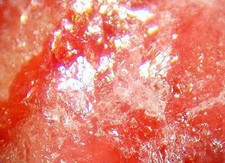 TUGTUPITE - Rich Thumbnail -