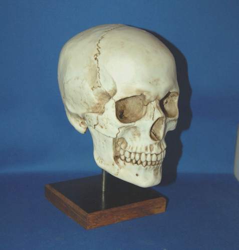 Detailed larger resin - a,