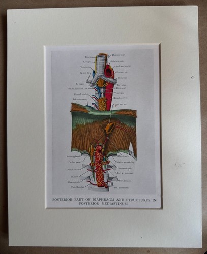 Anatomical medical print - medical,