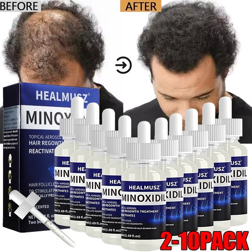 10pack minoxidil extra - 2-10pack,