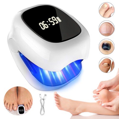Nail fungus laser device - laser,