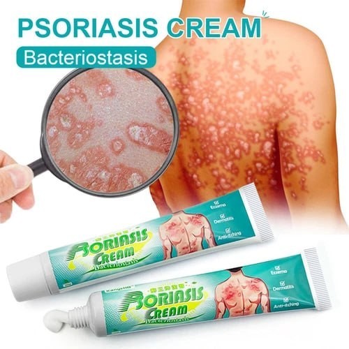 Antibacterial cream skin - antibacterial,