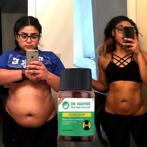 Fat loss herboslim tablets - loss,