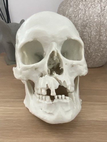 Battle visby skull life - battle,