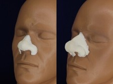 Prosthetic Bulbous Nose  Large