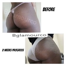 Vip EXTREME BUTT HIPS ENLARGEMENT HERBAL Bbl enlargement cream 