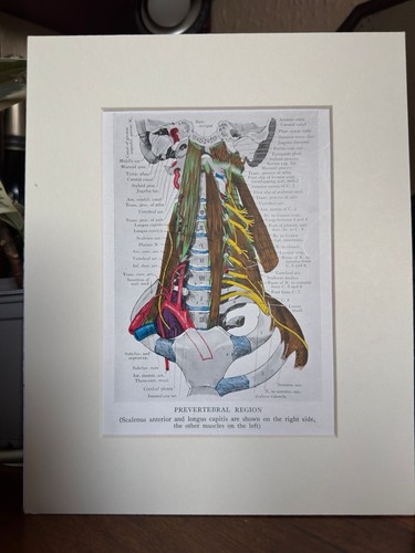Vintage anatomical neck print - vintage,