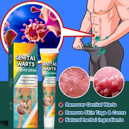 Genital herpes wart remover - herpes,