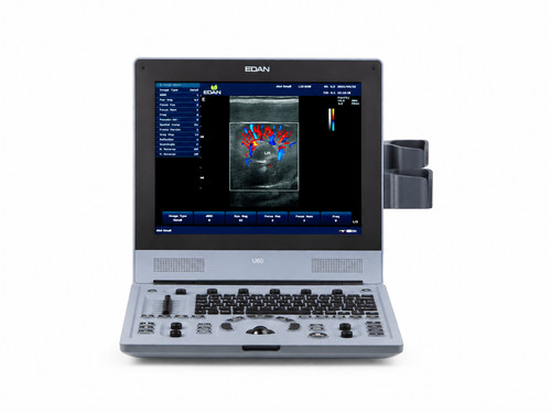 Edan u60 vet ultrasound - u60,