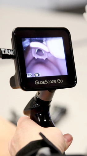 Verathon glidescope video - verathon,